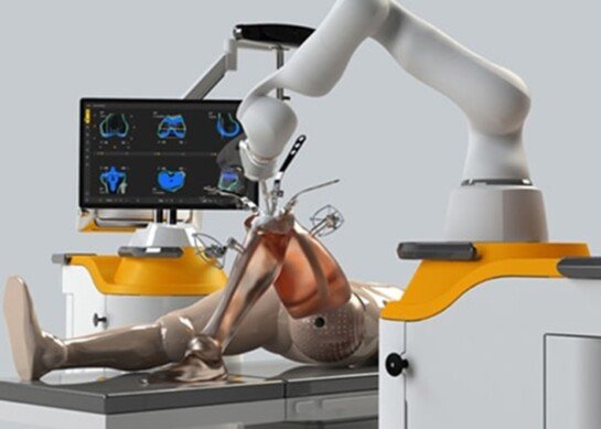 The Revolution of Robotic Knee Replacement Surgery