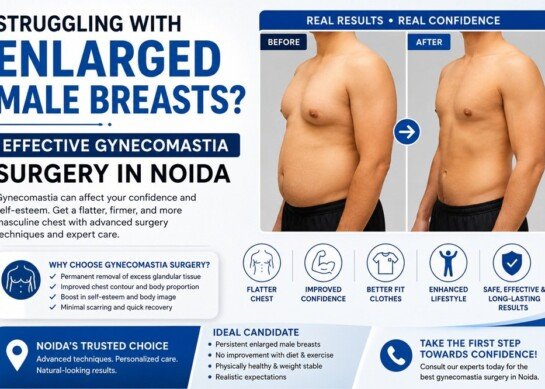 Struggling with Enlarged Male Breasts? Effective Gynecomastia Surgery in Noida